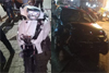 Manipal: Scooter rider seriously injured in collision with car